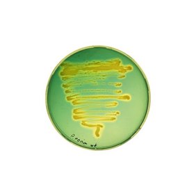 Wildtyp-Stamm von Pandoraea norimbergensis auf einer Chrom-Azurol-S-(CAS)-Agarplatte. Wildtyp-Stamm von Pandoraea norimbergensis auf einer Chrom-Azurol-S-(CAS)-Agarplatte.