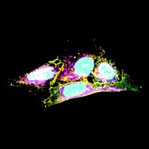 Das Bild zeigt Zellen, in denen Creld1 mit einem gelben Farbstoff markiert wurde, um seine Lokalisation in der Zelle anzuzeigen. 