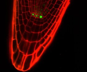 Die Spitze einer Pflanzenwurzel unter dem Fluoreszenzmikroskop. 