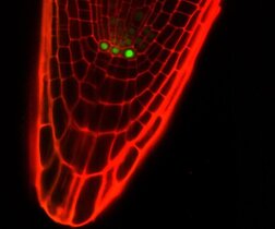 Die Spitze einer Pflanzenwurzel unter dem Fluoreszenzmikroskop. 