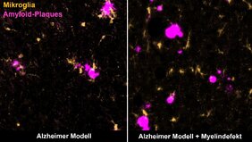 Alzheimer Nervenzellen Myelin