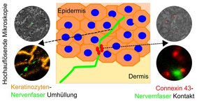 Mit Hilfe hochauflösender Mikroskopie konnte die AG von Prof. Nurcan Üçeyler am UKW zeigen, dass Nervenfasern in der obersten Hautschicht von Hautzellen, Keratinozyten, umhüllt sind.