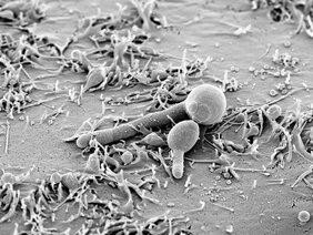 Candida albicans in der Hefe- und Hyphenform auf menschlichen Epithelzellen. 