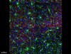 Das Bild zeigt die Verteilung der Mikroglia (grün) in den verschiedenen Schichten (orange) des visuellen Kortex einer Maus.