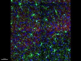 Das Bild zeigt die Verteilung der Mikroglia (grün) in den verschiedenen Schichten (orange) des visuellen Kortex einer Maus.