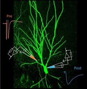 Moosfaser-Synapse im Hippocampu