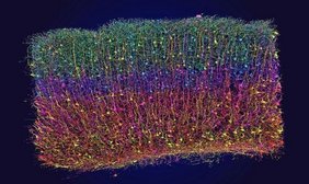 3D-Rekonstruktion von Neuronen aus elektronenmikroskopischen Daten 3D-Rekonstruktion von Neuronen aus elektronenmikroskopischen Daten