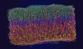 3D-Rekonstruktion von Neuronen aus elektronenmikroskopischen Daten