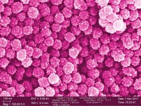 Zum Fürchten schön? Nanoplastik, elektronenmikroskopische Aufnahme