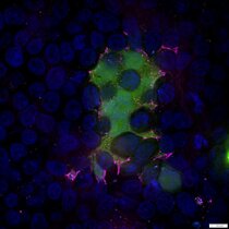 Mikroskopisches Bild von mit RSV infizierten Zellen