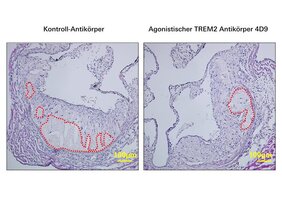 Die Behandlung mit dem agonistischen TREM2-Antikörper 4D9 führt zur Ausbildung kleinerer nekrotischer Kerne (rote Umrandungen) in atherosklerotischen Plaques der Aortenwurzel in Ldlr-/- Mäusen