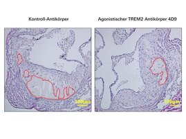 Die Behandlung mit dem agonistischen TREM2-Antikörper 4D9 führt zur Ausbildung kleinerer nekrotischer Kerne (rote Umrandungen) in atherosklerotischen Plaques der Aortenwurzel in Ldlr-/- Mäusen