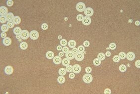 Cryptococcus neoformans