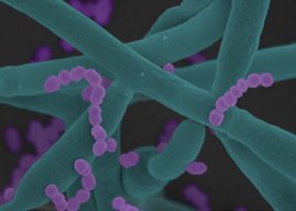 Rasterelektronenmikroskopische Aufnahme: Bakterien der Art Enterococcus faecalis (lila) binden an Hyphen des Pilzes Candida albicans (türkis).