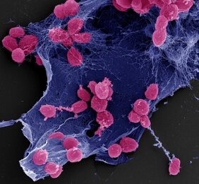 Rasterelektronenmikroskopische Aufnahme von Stieleria maiorica. Zellen in pink. Matrix in blau. 
