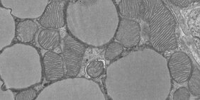 Elektronenmikroskopische Aufnahmen von Mitochondrien im braunen Fettgewebe.