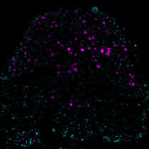   Bild der Piezo2-Genexpression (in Magenta dargestellt) in Schnitten aus dem lumbalen Spinalwurzelganglien von Mäusen.
