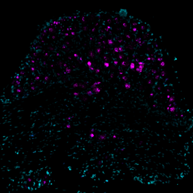   Bild der Piezo2-Genexpression (in Magenta dargestellt) in Schnitten aus dem lumbalen Spinalwurzelganglien von Mäusen.