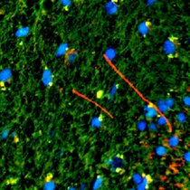 Charakterisierung eines zilientragenden Astrozyten-Subtyps Charakterisierung eines zilientragenden Astrozyten-Subtyps