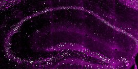 Querschnitt durch den Hippocampus einer Maus