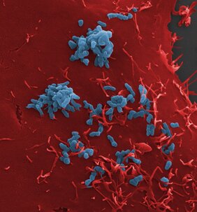 Adhäsion von Bartonella henselae