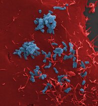 Adhäsion von Bartonella henselae