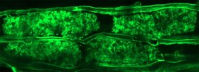 Lichtmikroskopisches Bild von Mykorrhiza in Wurzelriundenzellen, grün gefärbt