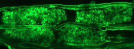 Lichtmikroskopisches Bild von Mykorrhiza in Wurzelriundenzellen, grün gefärbt
