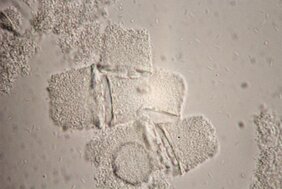 Mischkultur aus dem Pilzpathogen Pseudomonas tolaasii und dem Helferbakterium Mycetocola tolaasinivorans. 