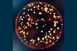 P. aeruginosa-Bakterien, die mit einem gelbem oder roten Fluoreszenzmarker markiert wurden, und hier auf einer Agarplatten gewachsen sind.