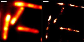 Darmbakterien mit konventioneller Epifluoreszenzmikroskopie (links) und höchstauflösender Einzelmolekül-Lokalisationsmikroskopie