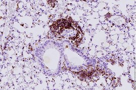 CD45-Färbung von Lungenalveolargewebe in einem neuen SCLC-Mausmodell.