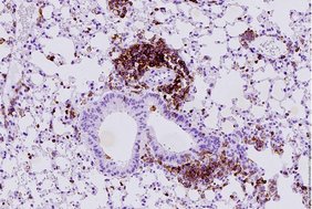 CD45-Färbung von Lungenalveolargewebe in einem neuen SCLC-Mausmodell.