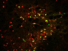 CRH-Neurone in der IPACL-Region