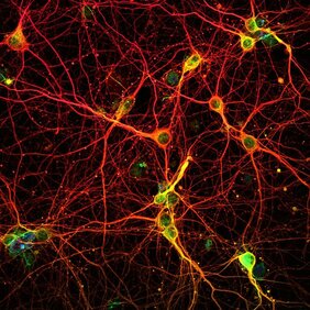 Neuronen in der Großhirnrinde einer Maus  