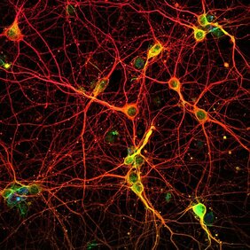 Neuronen in der Großhirnrinde einer Maus  