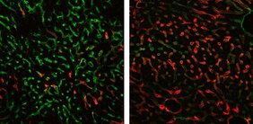 Die Immunfluoreszenzfärbung für Endomucin (grün) und LYVE-1 (rot) illustriert Veränderungen der Blutgefäße nach GATA4-Verlust in der fibrotischen Leber