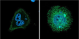 Die Mikroskopaufnahmen zeigen eine koordinierte Konzentration des nicht-mutierten FCHO1 Proteins an der Zellmembran (links) im Vergleich zur chaotischen Fehlverteilung des mutierten FCHO1 Proteins (rechts)