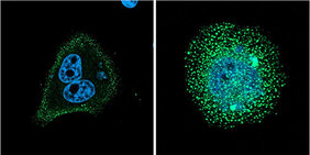 Die Mikroskopaufnahmen zeigen eine koordinierte Konzentration des nicht-mutierten FCHO1 Proteins an der Zellmembran (links) im Vergleich zur chaotischen Fehlverteilung des mutierten FCHO1 Proteins (rechts)