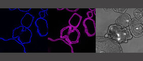 Die Bilder zeigen die jeweils gleichen Magen-Organoide: Es zeigt die Zellkerne (blau) und das Skelett der Zelle (pink) als Querschnitt aus den Organoiden. In grau ist das mikroskopische Bild der Organoide. 