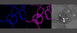 Die Bilder zeigen die jeweils gleichen Magen-Organoide: Es zeigt die Zellkerne (blau) und das Skelett der Zelle (pink) als Querschnitt aus den Organoiden. In grau ist das mikroskopische Bild der Organoide. 