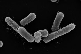 Elektronenmikroskopische Aufnahme des E. coli-Stamms, der multiresistente E. coli-Stämme verdrängen kann. 