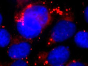 Nach Hemmung der Sekretase sammeln sich in den Astrozyten (ihr Zellkern ist blau gefärbt), große Mengen von Lipidtröpfchen (rot) an. Diese stören die normale Zellfunktion. 