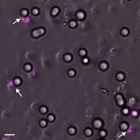 NK-Zellen und mit Antikörper beladenen Beads: Ein Aktivierungsmarker (pink) zeigt, dass diese NK-Zellen so viel Signal von den Beads erhalten haben, dass ihr Tötungsmechanismus eingeleitet wurde. 