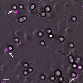 NK-Zellen und mit Antikörper beladenen Beads: Ein Aktivierungsmarker (pink) zeigt, dass diese NK-Zellen so viel Signal von den Beads erhalten haben, dass ihr Tötungsmechanismus eingeleitet wurde. 