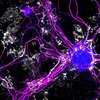 Ko-Kulturen bestehend aus Neuronen, die Nervenfasern (pink) ausbilden und Oligodendrozyten, die diese Nervenfasern mit Myelin (weiß) ummanteln.