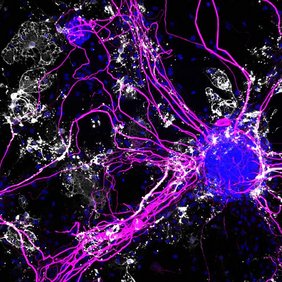 Ko-Kulturen bestehend aus Neuronen, die Nervenfasern (pink) ausbilden und Oligodendrozyten, die diese Nervenfasern mit Myelin (weiß) ummanteln.