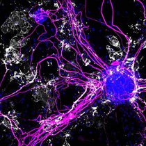 Ko-Kulturen bestehend aus Neuronen, die Nervenfasern (pink) ausbilden und Oligodendrozyten, die diese Nervenfasern mit Myelin (weiß) ummanteln.