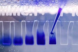 Proteine von Brustkrebszellen werden an der Uni Jena mittels Gelelektrophorese aufgetrennt und analysiert