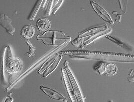 Lichtmikroskopische Aufnahme von Glasschalen verschiedener, einzelliger Kieselalgen 